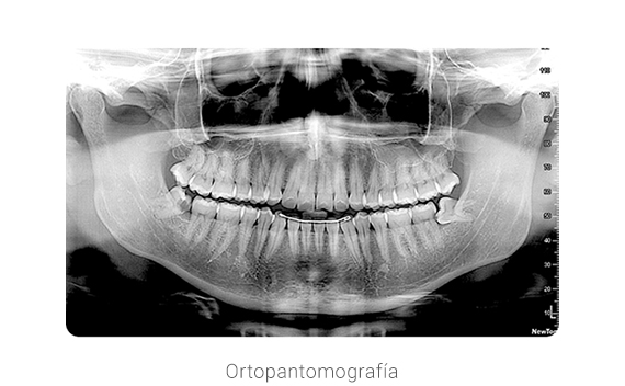 Ortopantomografía
